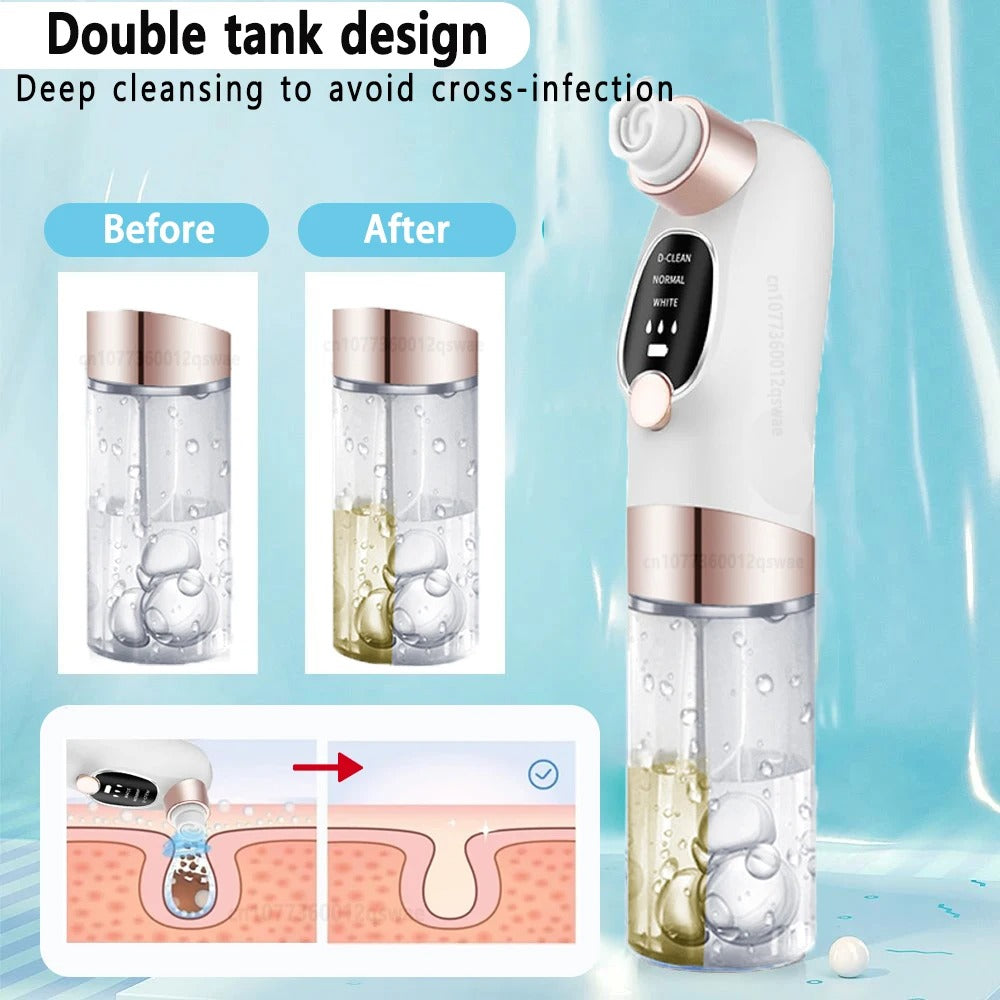 Blackhead Remover Tool