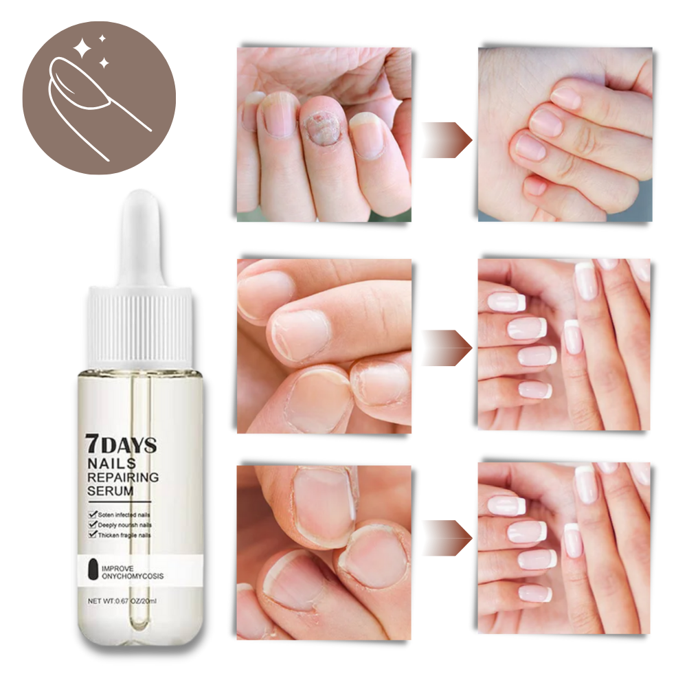 7 Days Nail Repair Essence