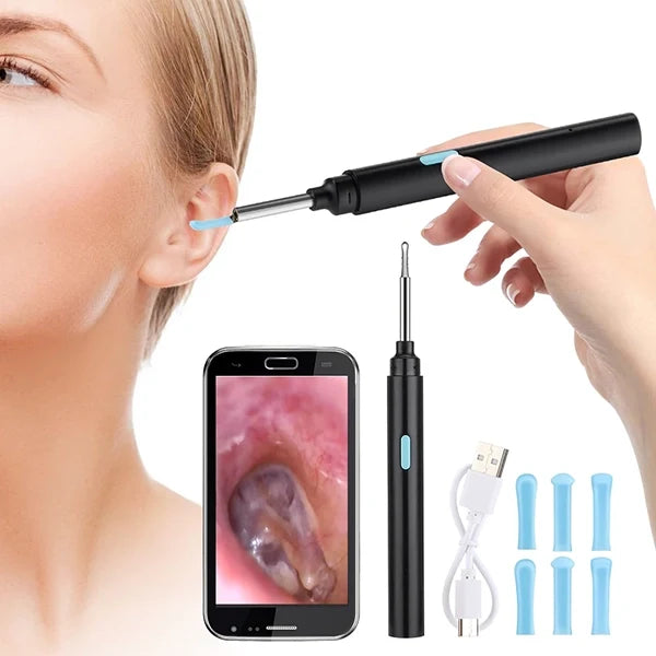 Intelligent Visual Device for Removing Earwax