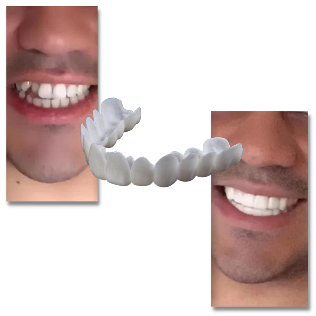 Dental coverage for a perfect smile - comfortable aligners
