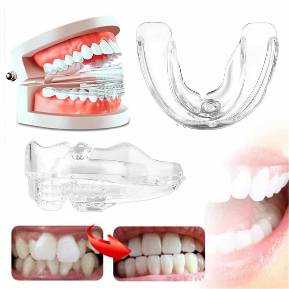 Invisible Dental Realignment Tray