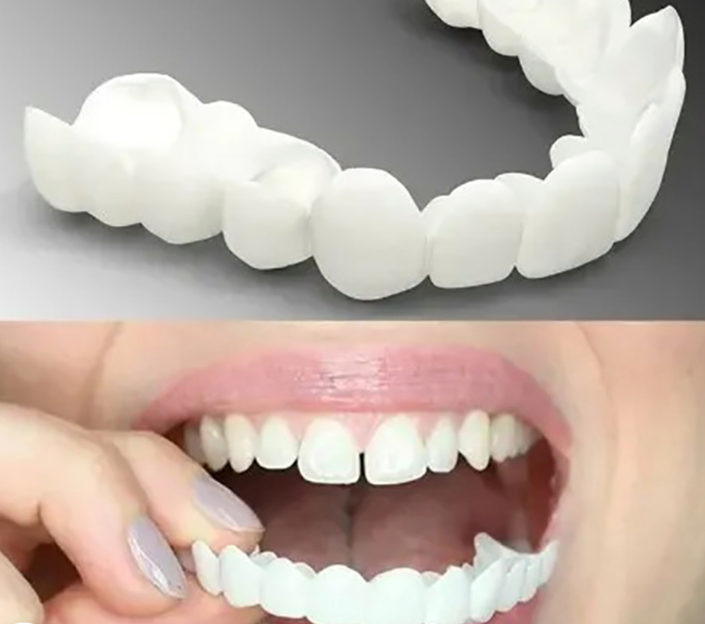 Adjustable Snap-On Dentures
