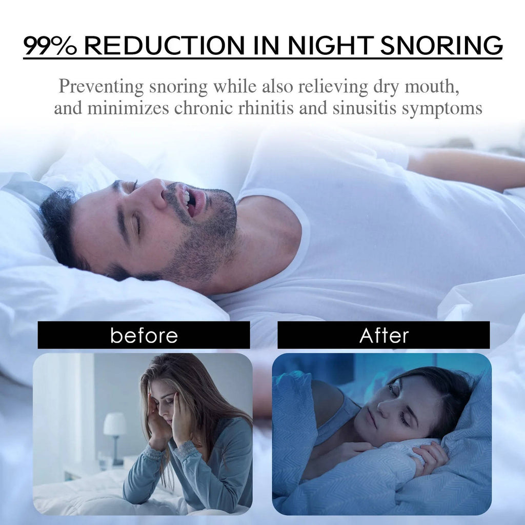 Mouth Tapes Anti Snoring