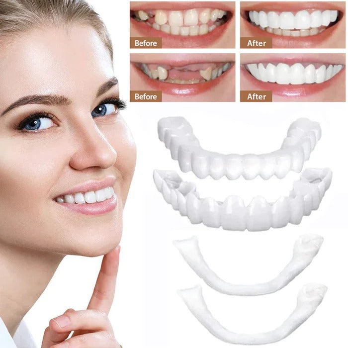Veneers for Teeth with Natural White Finish