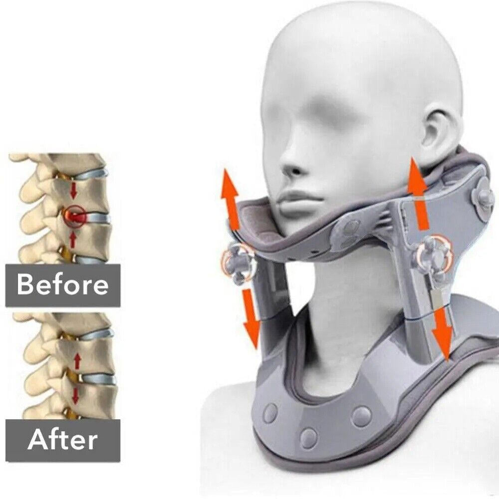 Neck Stretcher Traction Device